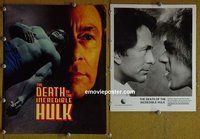 J452 DEATH OF THE INCREDIBLE HULK presskit90 Bill Bixby